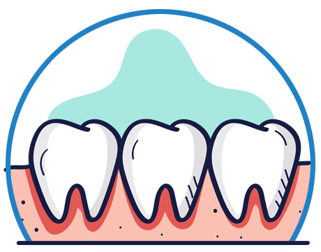Gum Health